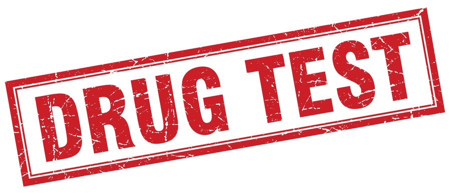 Am I Required to do a Drug Test for Workers' Comp?