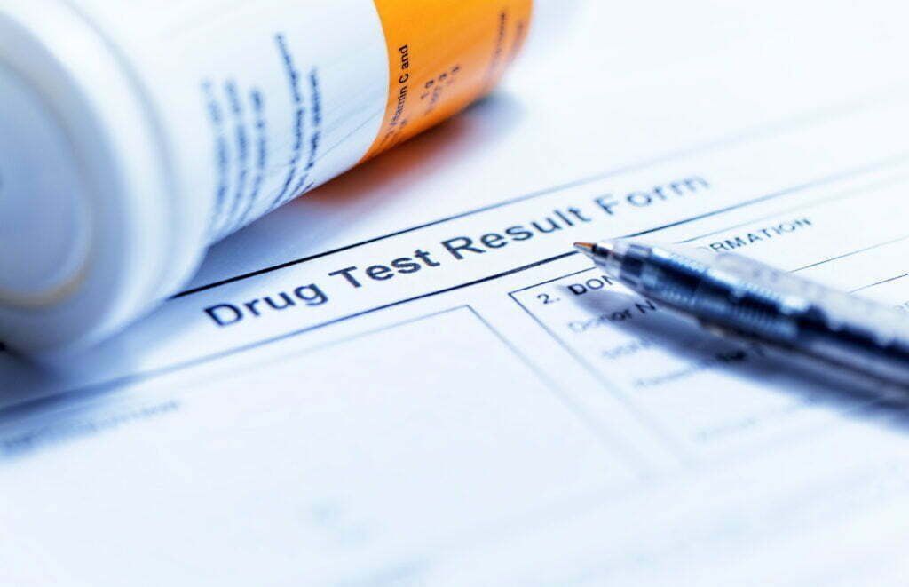 Am I Required to do a Drug Test for Workers' Comp? 15171478 Drug Test Blank Form 1024x661