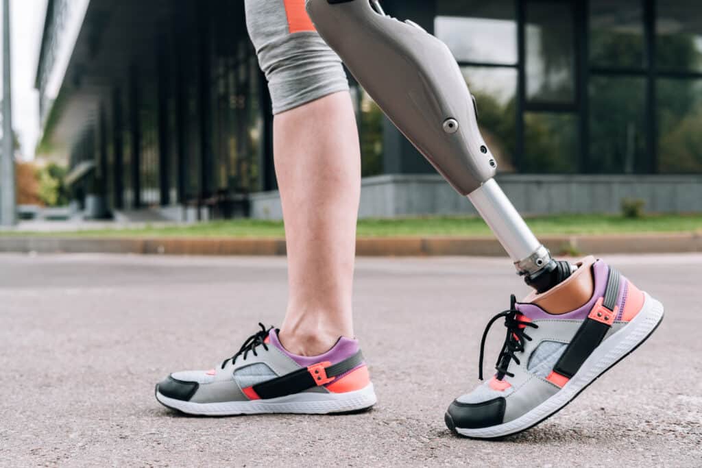 What is Permanent Partial Disability and How Do I Qualify for It? What is Permanent Partial Disability and How Do I Qualify for It